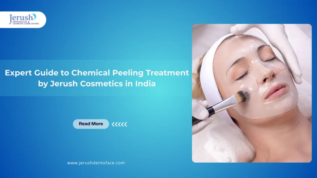 image showing chemical peeling Treatment