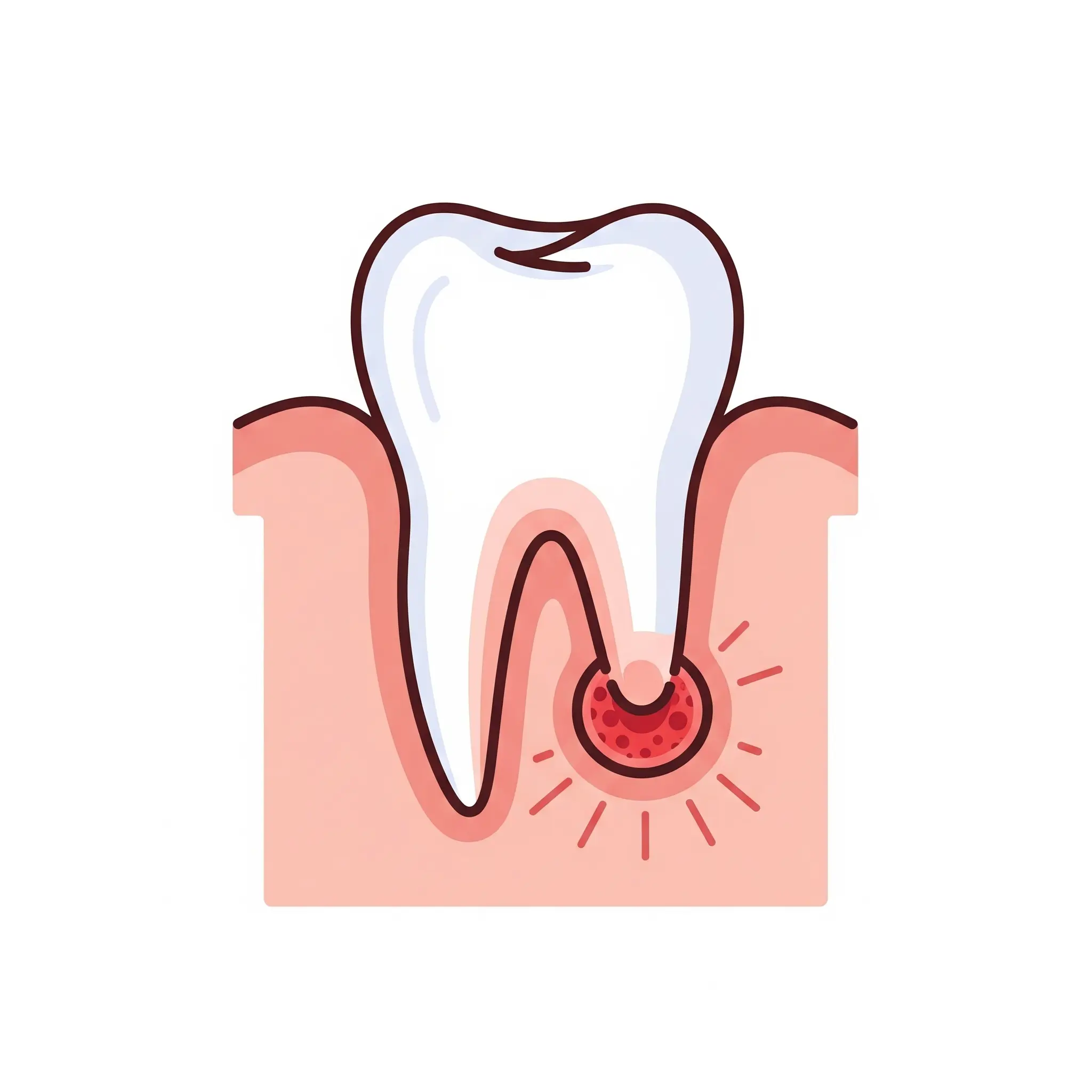 infection near the teeth root
