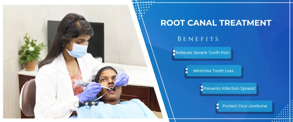 root canal treatment