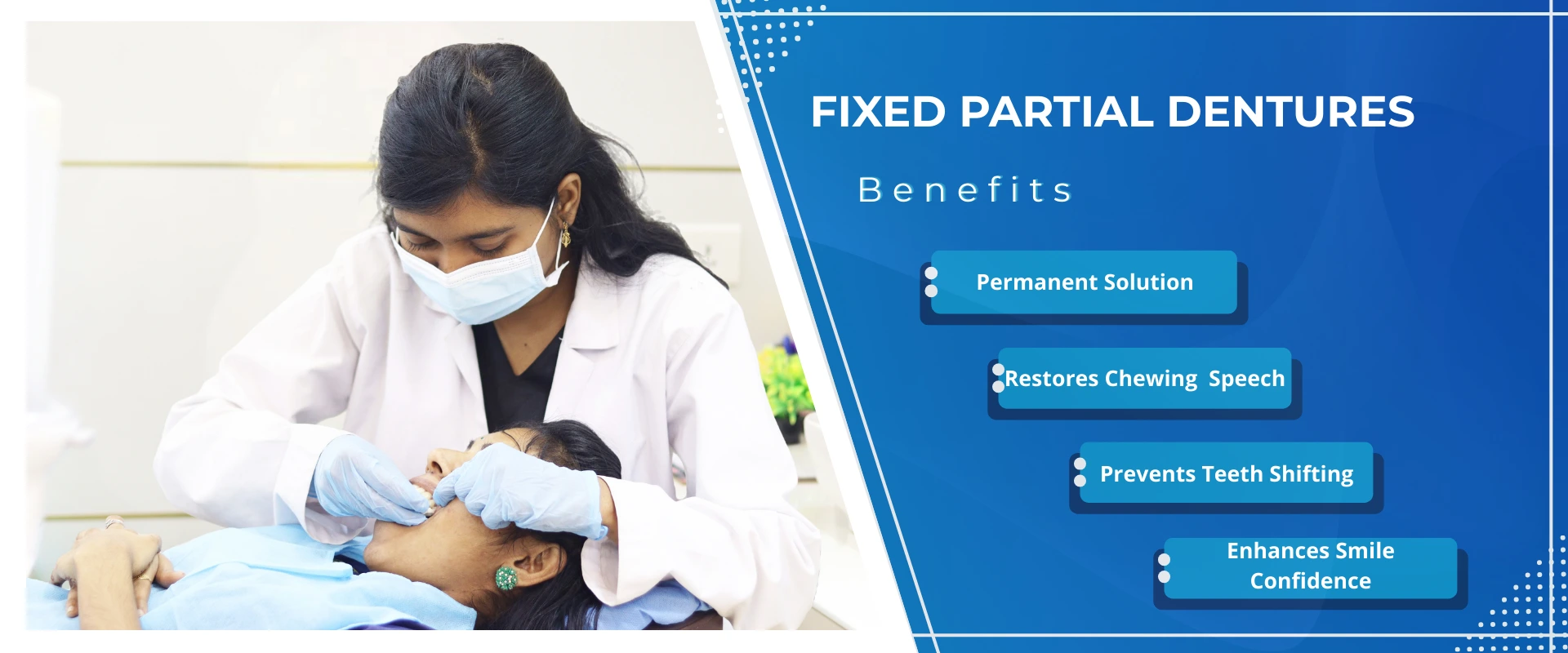 Fixed partial Denture