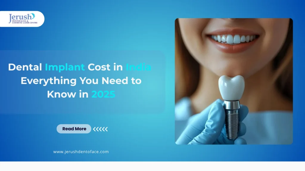 Dental implant blog banner showing a smiling woman holding a titanium dental implant model, with the title 'Dental Implant Cost in India – Everything You Need to Know in 2025' and Jerush Dentofacial & Cosmetic Laser Centre logo on a blue gradient background