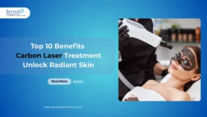 Banner promoting the top 10 benefits of carbon laser treatment at Jerush Dentofacial & Cosmetic Laser Centre, featuring a woman undergoing the procedure with a carbon mask and laser device.