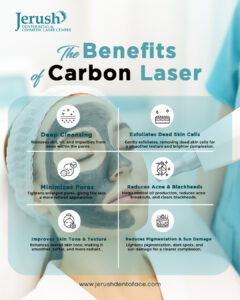 Infographic showing the benefits of Carbon Laser treatment at Jerush Dentofacial & Cosmetic Laser Centre, including deep cleansing, exfoliation, minimized pores, acne reduction, improved skin tone, and reduced pigmentation 
