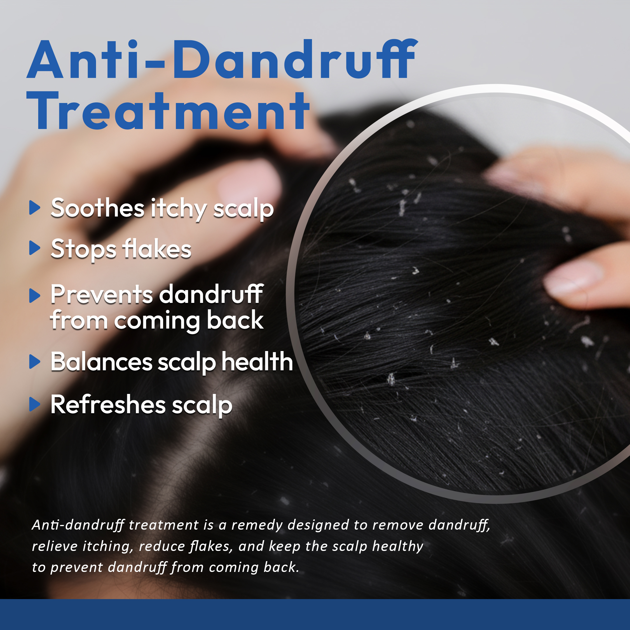 benefits of anti dandruff treatement in chennai