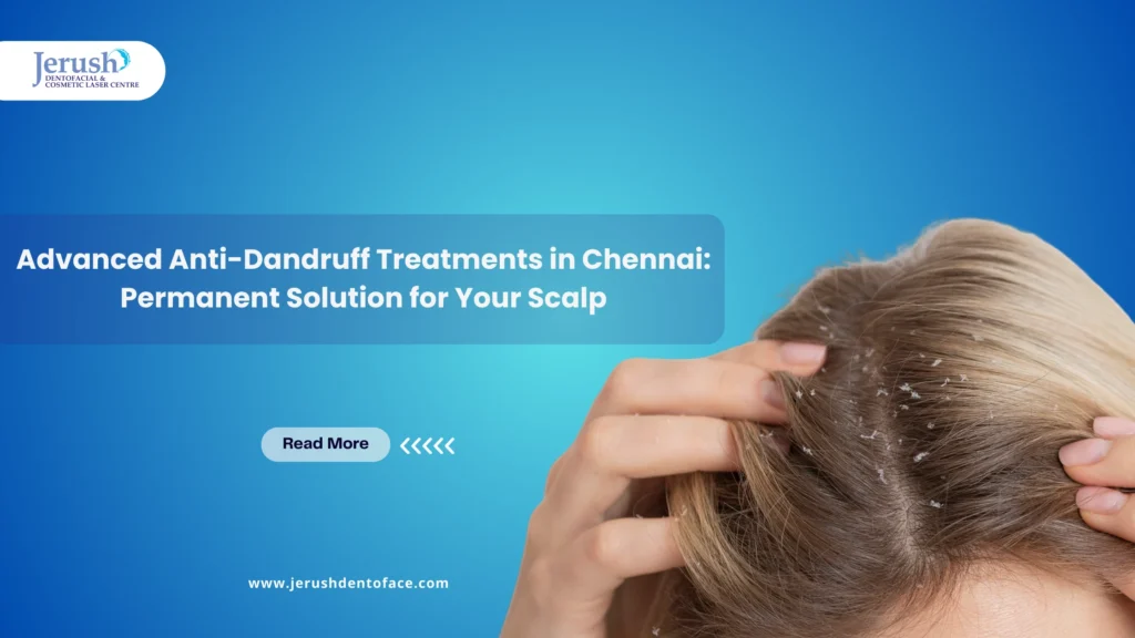 anti dandruff treatment in chennai