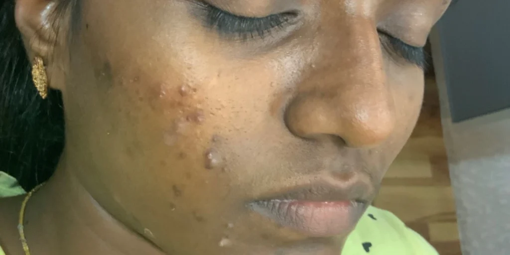 before the treatment of skin brightening